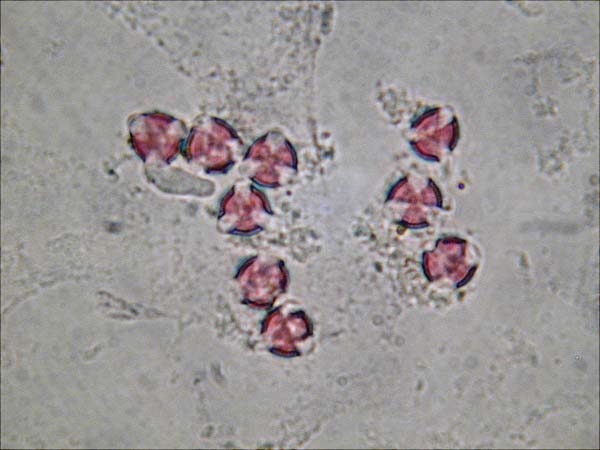 Aeonium holochrysum2
