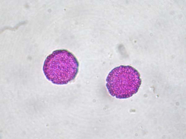 Anemopaegma chamberleyii1