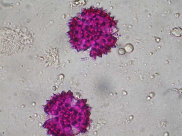 Cynaria scolymus1