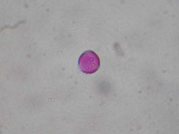 Cytisus sessifolius2