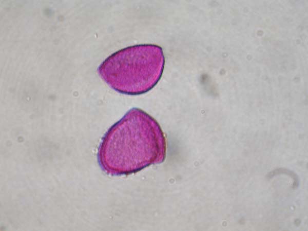Triteleia ixiodes1