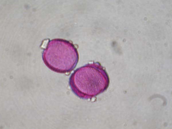 Triteleia ixiodes2