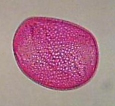 amaryllis pollen pic